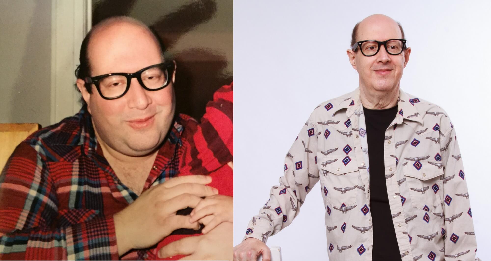 Mike Meltzer before after