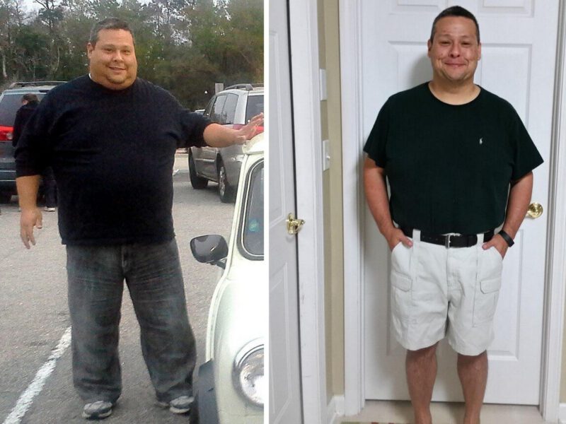 Kelvin Suarez before after-003